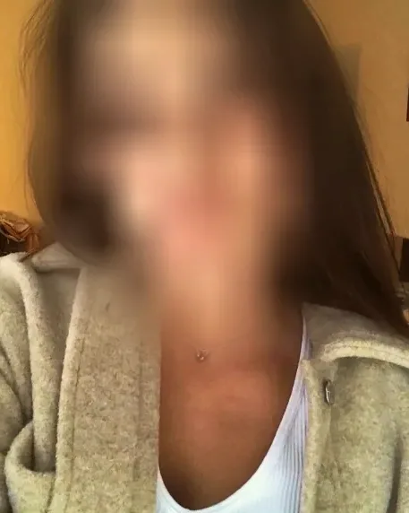Signe, 28